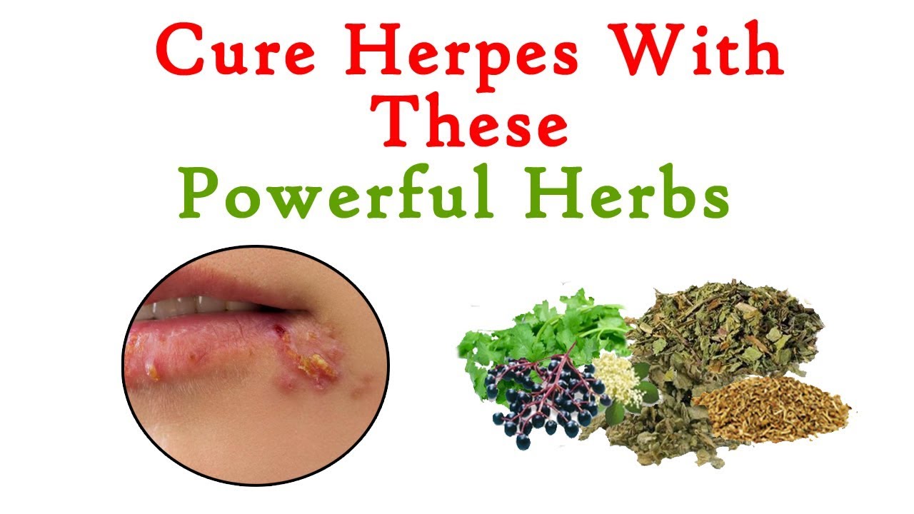 WHAT IS HERPES HOW TO TREAT HERPES